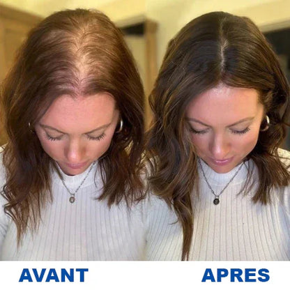 Sérum pour inverser la chute des cheveux