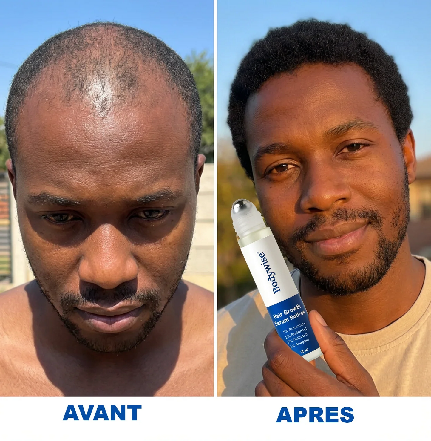 Sérum pour inverser la chute des cheveux