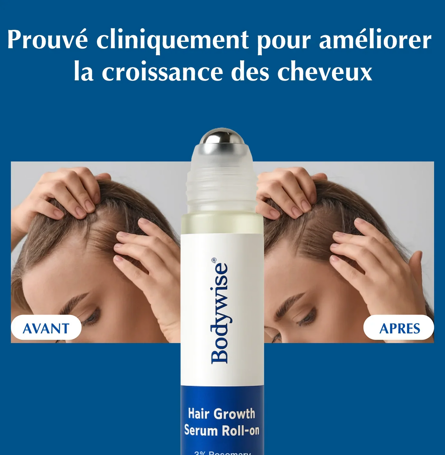 Sérum pour inverser la chute des cheveux