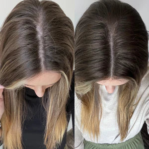 Sérum pour inverser la chute des cheveux